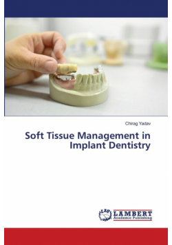 Soft Tissue Management in Implant Dentistry