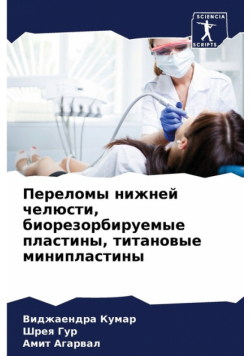 Переломы нижней челюсти, биорезорбируемые пластины, титановые минипластины