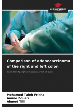 Comparison of adenocarcinoma of the right and left colon