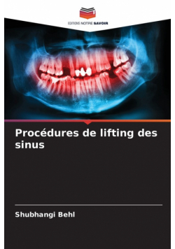 Procédures de lifting des sinus