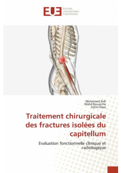 Traitement chirurgicale des fractures isolées du capitellum