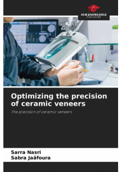 Optimizing the precision of ceramic veneers