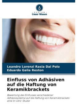 Einfluss von Adhäsiven auf die Haftung von Keramikbrackets