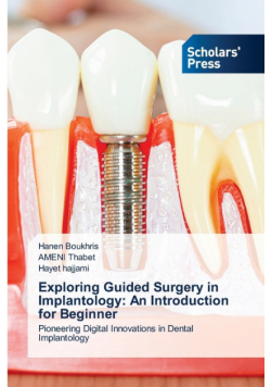 Exploring Guided Surgery in Implantology