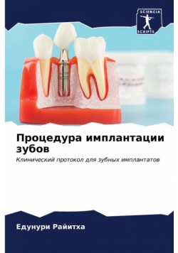 Процедура имплантации зубов