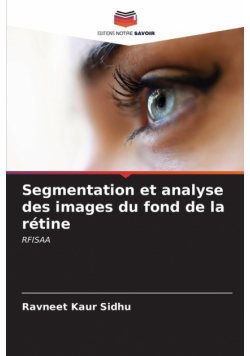 Segmentation et analyse des images du fond de la rétine