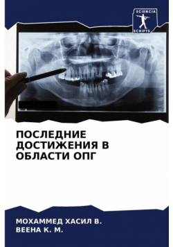 ПОСЛЕДНИЕ ДОСТИЖЕНИЯ В ОБЛАСТИ ОПГ