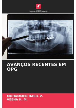 Avanços Recentes Em Opg