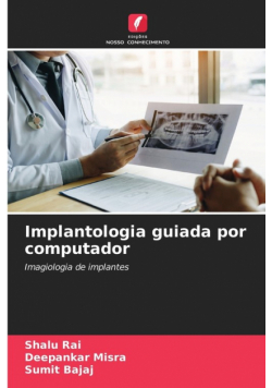 Implantologia guiada por computador