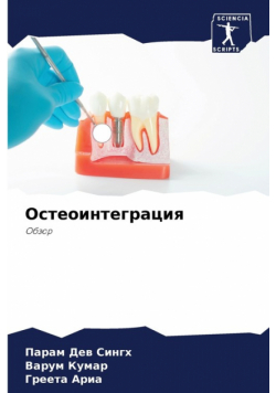 Остеоинтеграция