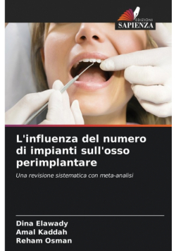 L'influenza del numero di impianti sull'osso perimplantare