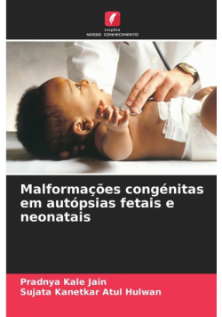 Malformações congénitas em autópsias fetais e neonatais