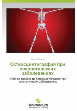 Osteostsintigrafiya Pri Onkologicheskikh Zabolevaniyakh