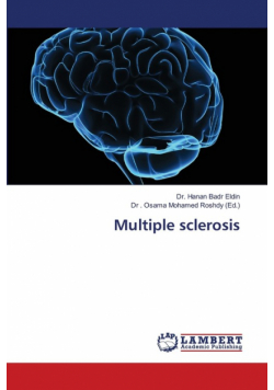 Multiple sclerosis