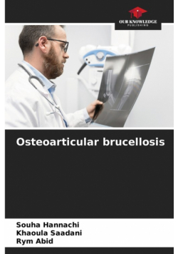 Osteoarticular brucellosis