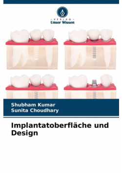 Implantatoberfläche und Design
