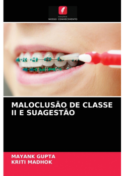 Maloclusão De Classe Ii E Suagestão