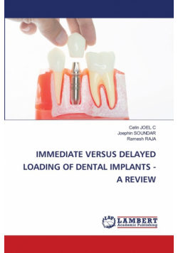 Immediate Versus Delayed Loading Of Dental Implants - A Review