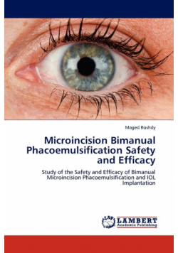 Microincision Bimanual Phacoemulsification Safety and Efficacy
