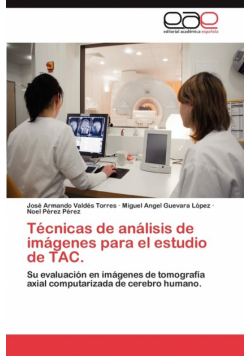 Técnicas de análisis de imágenes para el estudio de TAC.