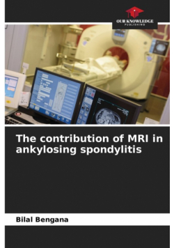 The contribution of MRI in ankylosing spondylitis