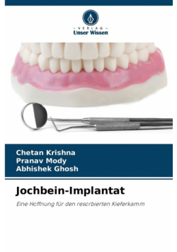 Jochbein-Implantat