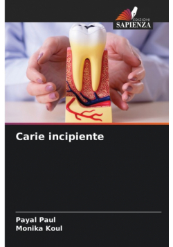 Carie incipiente