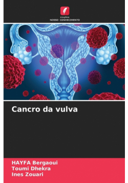 Cancro da vulva