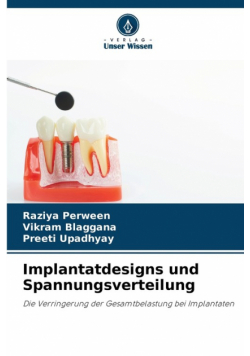 Implantatdesigns und Spannungsverteilung