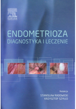 Endometrioza diagnostyka i leczenie