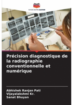 Précision diagnostique de la radiographie conventionnelle et numérique