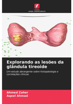 Explorando as lesões da glândula tireoide