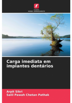 Carga imediata em implantes dentários