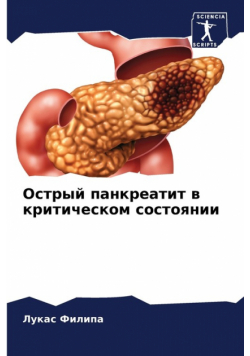 Острый панкреатит в критическом состоянии