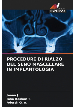 Procedure Di Rialzo Del Seno Mascellare In Implantologia