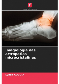 Imagiologia das artropatias microcristalinas