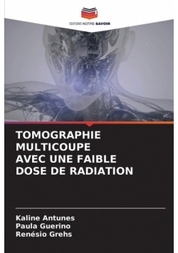 Tomographie Multicoupe Avec Une Faible Dose De Radiation