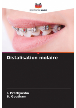 Distalisation molaire