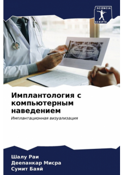 Имплантология с компьютерным наведением
