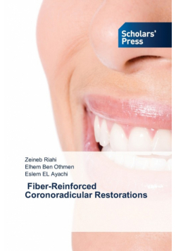 ‎ Fiber-Reinforced Coronoradicular Restorations