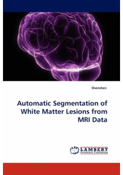 Automatic Segmentation of White Matter Lesions from MRI Data