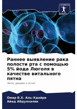 Раннее выявление рака полости рта с помощью 5% йода Люголя в качестве витального пятна
