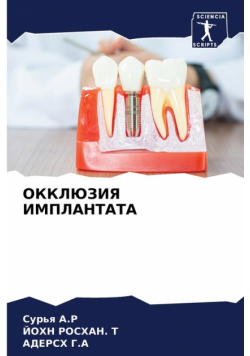ОККЛЮЗИЯ ИМПЛАНТАТА