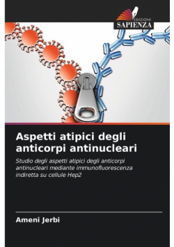 Aspetti atipici degli anticorpi antinucleari