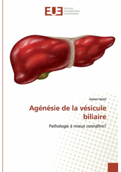 Agénésie de la vésicule biliaire