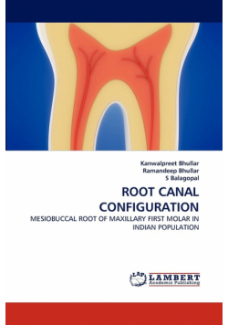 Root Canal Configuration