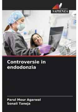 Controversie in endodonzia
