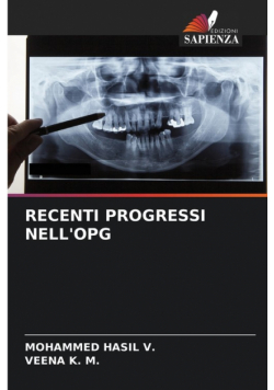 Recenti Progressi Nell'opg