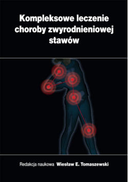 Kompleksowe Leczenie Choroby Zwyrodnieniowej Stawów