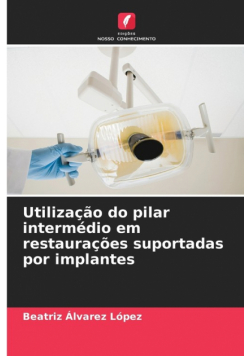 Utilização do pilar intermédio em restaurações suportadas por implantes
